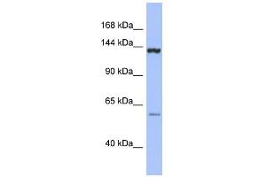 Image no. 1 for anti-DEAH (Asp-Glu-Ala-His) Box Polypeptide 34 (DHX34) (Middle Region) antibody (ABIN2775224)