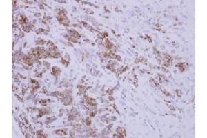 IHC-P Image Immunohistochemical analysis of paraffin-embedded BT483 xenograft, using TID1, antibody at 1:250 dilution.