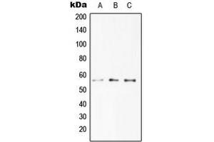 Image no. 1 for anti-Drought-Repressed 4 Protein (DR4) (C-Term) antibody (ABIN2704730)