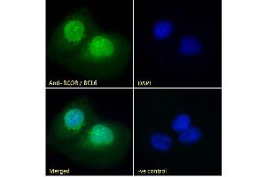 Image no. 2 for anti-BCL6 Co-Repressor (BCOR) (N-Term) antibody (ABIN185043)
