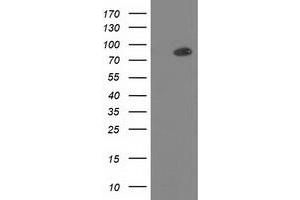 Image no. 14 for anti-Protein Kinase C, epsilon (PRKCE) antibody (ABIN1500229)