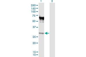 Image no. 2 for anti-Empty Spiracles Homeobox 2 (EMX2) (AA 1-252) antibody (ABIN515277)