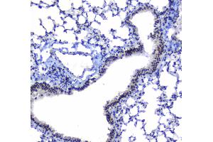 Image no. 5 for anti-Splicing Factor 1 (SF1) (AA 160-266) antibody (ABIN5692946)
