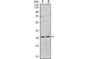 Image no. 1 for anti-Protein Phosphatase 1, Catalytic Subunit, alpha Isoform (PPP1CA) antibody (ABIN933017)