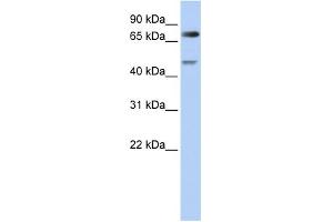 Image no. 1 for anti-Denticleless E3 Ubiquitin Protein Ligase Homolog (DTL) (N-Term) antibody (ABIN2782560)