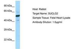 Image no. 1 for anti-Succinate-CoA Ligase, GDP-Forming, beta Subunit (SUCLG2) (AA 258-307) antibody (ABIN6750076)