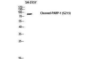 Image no. 2 for anti-Poly (ADP-Ribose) Polymerase 1 (PARP1) (Asp214), (cleaved) antibody (ABIN3181849)