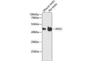 Western blot analysis of extracts of various cell lines using AREG Polyclonal Antibody at dilution of 1:3000.