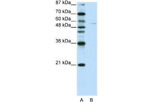 Image no. 1 for anti-Grainyhead-Like 3 (GRHL3) (C-Term) antibody (ABIN2781145)