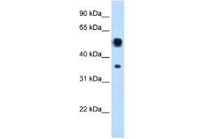 Image no. 1 for anti-Argininosuccinate Lyase (ASL) (N-Term) antibody (ABIN631440)