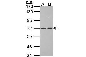 anti-Protein O-Linked Mannose Beta1,2-N-Acetylglucosaminyltransferase (POMGNT1) (Center) antibody