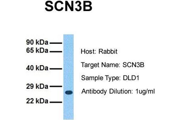 anti-Sodium Channel, Voltage-Gated, Type III, beta Subunit (SCN3B) (N-Term) antibody