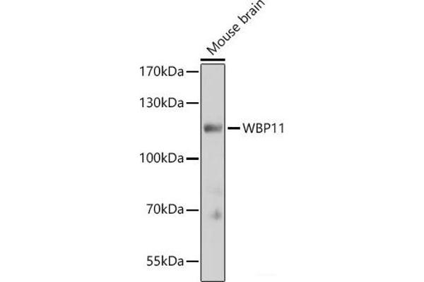 WBP11 anticorps