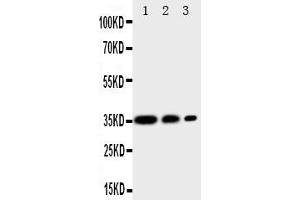 Image no. 3 for anti-CD163 (CD163) (AA 1056-1165) antibody (ABIN5518691)