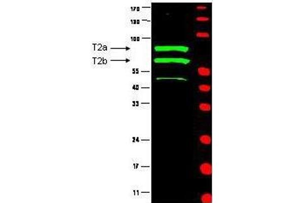 anti-Cyclin T2 (CCNT2) (AA 1-584) antibody