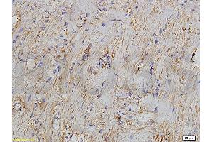 Image no. 2 for anti-B-Cell CLL/lymphoma 2 (BCL2) (AA 101-160) antibody (ABIN723920)
