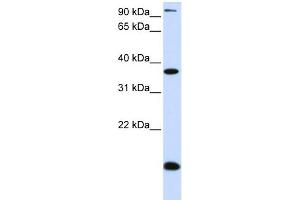 Image no. 1 for anti-Kruppel-Like Factor 8 (KLF8) (N-Term) antibody (ABIN2787477)