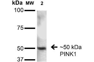 Image no. 2 for anti-PTEN Induced Putative Kinase 1 (PINK1) (AA 112-496) antibody (Alkaline Phosphatase (AP)) (ABIN1741116)