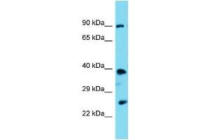 Image no. 1 for anti-Proline-serine-threonine Phosphatase Interacting Protein 2 (PSTPIP2) (N-Term) antibody (ABIN2774332)