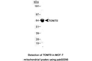 Image no. 2 for anti-Translocase of Outer Mitochondrial Membrane 70 (TOMM70A) (AA 1-100) antibody (ABIN2852236)