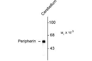 Image no. 1 for anti-Peripherin (PRPH) antibody (ABIN361363)