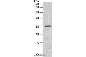 Image no. 2 for anti-Paired Box 1 (PAX1) antibody (ABIN2426331)