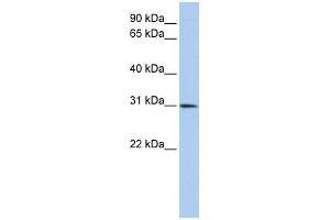 Image no. 1 for anti-Distal-Less Homeobox Protein 1 (DLX1) (C-Term) antibody (ABIN2777637)