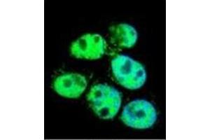 Image no. 3 for anti-Peptidylprolyl Isomerase C (Cyclophilin C) (PPIC) (AA 68-97), (Middle Region) antibody (ABIN951770)