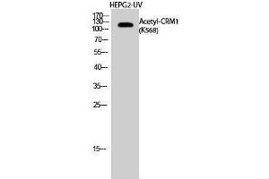 Image no. 1 for anti-Exportin 1 (XPO1) (acLys568) antibody (ABIN3188006)