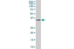 ZWINT monoclonal antibody (M04), clone 1B7.