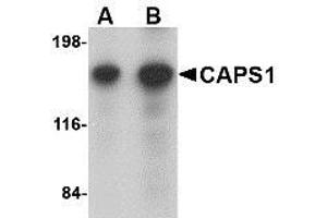 Image no. 2 for anti-Ca++-Dependent Secretion Activator (CADPS) (N-Term) antibody (ABIN499525)