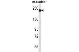 Image no. 2 for anti-BRCA1 Interacting Protein C-terminal Helicase 1 (BRIP1) (AA 135-167), (N-Term) antibody (ABIN950678)
