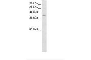Image no. 1 for anti-Fatty Acid Desaturase 1 (FADS1) (AA 428-477) antibody (ABIN204996)