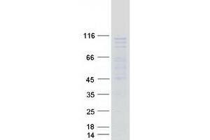 UTP25/DIEXF Protein (Myc-DYKDDDDK Tag)