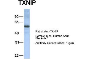 Image no. 2 for anti-Thioredoxin Interacting Protein (TXNIP) (C-Term) antibody (ABIN2784817)
