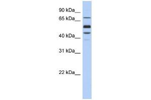 Image no. 1 for anti-Protein S (PROS) (Middle Region) antibody (ABIN2774131)