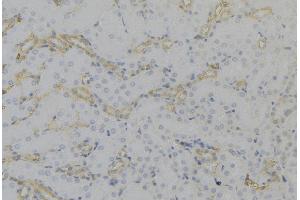 Image no. 1 for anti-Peroxisomal Biogenesis Factor 12 (PEX12) (Internal Region) antibody (ABIN6264148)