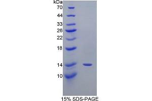 Image no. 1 for Prostaglandin-Endoperoxide Synthase 2 (Prostaglandin G/H Synthase and Cyclooxygenase) (PTGS2) (AA 240-351) protein (His tag) (ABIN1080576)