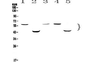 Image no. 1 for anti-Caspase 8 (CASP8) (AA 389-479) antibody (ABIN5693195)