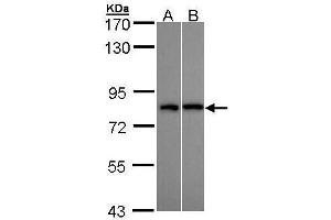 Image no. 4 for anti-DEAD (Asp-Glu-Ala-Asp) Box Polypeptide 3, X-Linked (DDX3X) (Center) antibody (ABIN2856700)