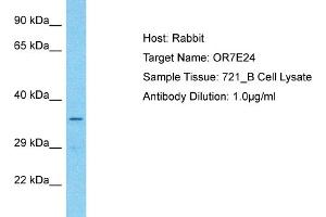 Image no. 1 for anti-Olfactory Receptor, Family 7, Subfamily E, Member 24 (OR7E24) (C-Term) antibody (ABIN2792035)
