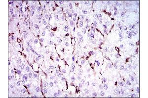 Image no. 1 for anti-Niemann-Pick Disease, Type C1 (NPC1) (AA 34-174) antibody (ABIN1845969)