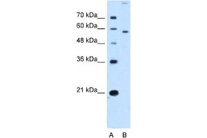 anti-Solute Carrier Family 22 (Organic Cation Transporter), Member 2 (SLC22A2) (N-Term) antibody
