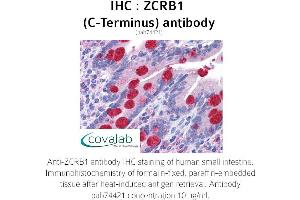 Image no. 1 for anti-Zinc Finger CCHC-Type and RNA Binding Motif 1 (ZCRB1) (C-Term) antibody (ABIN1740913)