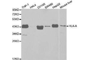 Image no. 3 for anti-Major Histocompatibility Complex, Class I, A (HLA-A) antibody (ABIN3023100)