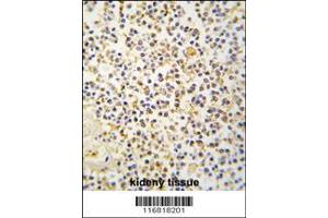 Image no. 2 for anti-Aldehyde Dehydrogenase 1 Family, Member A3 (ALDH1A3) (AA 24-51), (N-Term) antibody (ABIN392316)