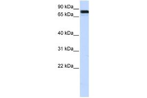 EWSR1 anticorps  (Middle Region)