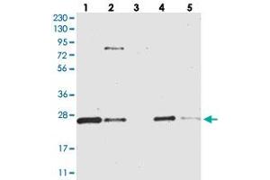 Image no. 2 for anti-Coiled-Coil Domain Containing 90B (CCDC90B) antibody (ABIN5573942)