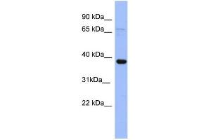 Image no. 1 for anti-Immediate Early Response 5 (IER5) (N-Term) antibody (ABIN2786983)