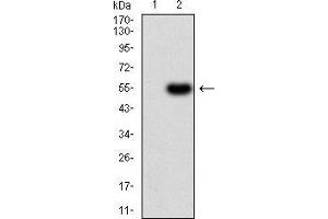 Image no. 4 for anti-serpin Peptidase Inhibitor, Clade A (Alpha-1 Antiproteinase, Antitrypsin), Member 1 (SERPINA1) (AA 23-237) antibody (ABIN5542585)